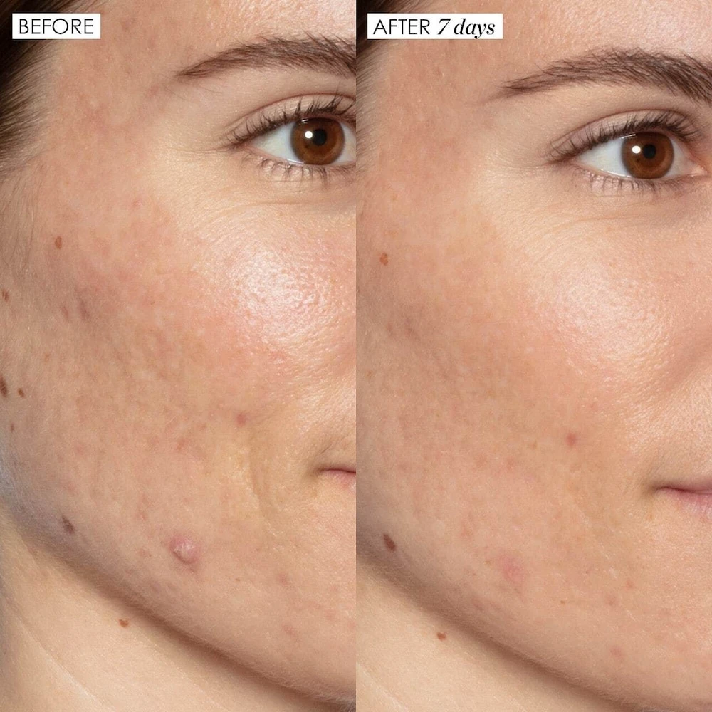 Good Genes All-In-One Lactic Acid Serum - Image 6